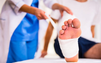Steps to Recovery After Foot Surgery